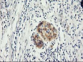 ILVBL Antibody in Immunohistochemistry (Paraffin) (IHC (P))