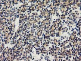 ILVBL Antibody in Immunohistochemistry (Paraffin) (IHC (P))