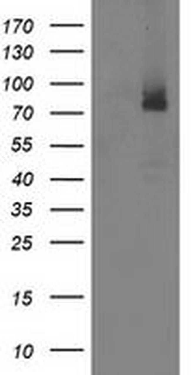 ILVBL Antibody in Western Blot (WB)