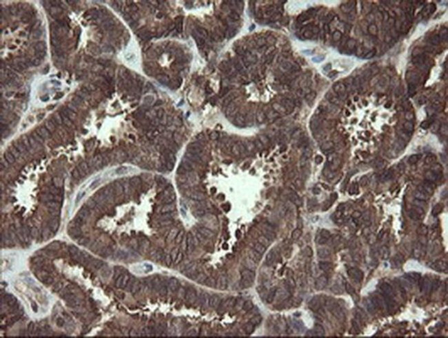 PBDC1 Antibody in Immunohistochemistry (Paraffin) (IHC (P))