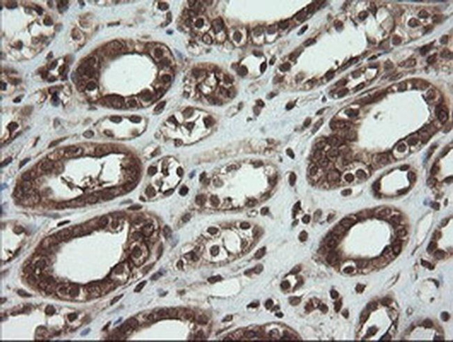 PBDC1 Antibody in Immunohistochemistry (Paraffin) (IHC (P))