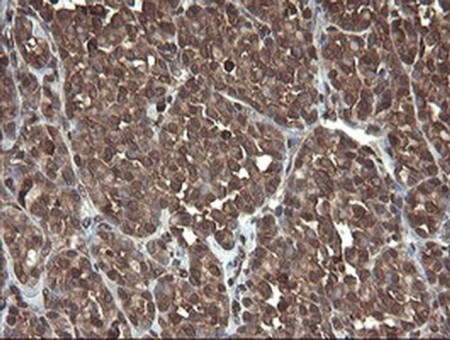 PBDC1 Antibody in Immunohistochemistry (Paraffin) (IHC (P))