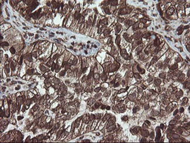 PBDC1 Antibody in Immunohistochemistry (Paraffin) (IHC (P))