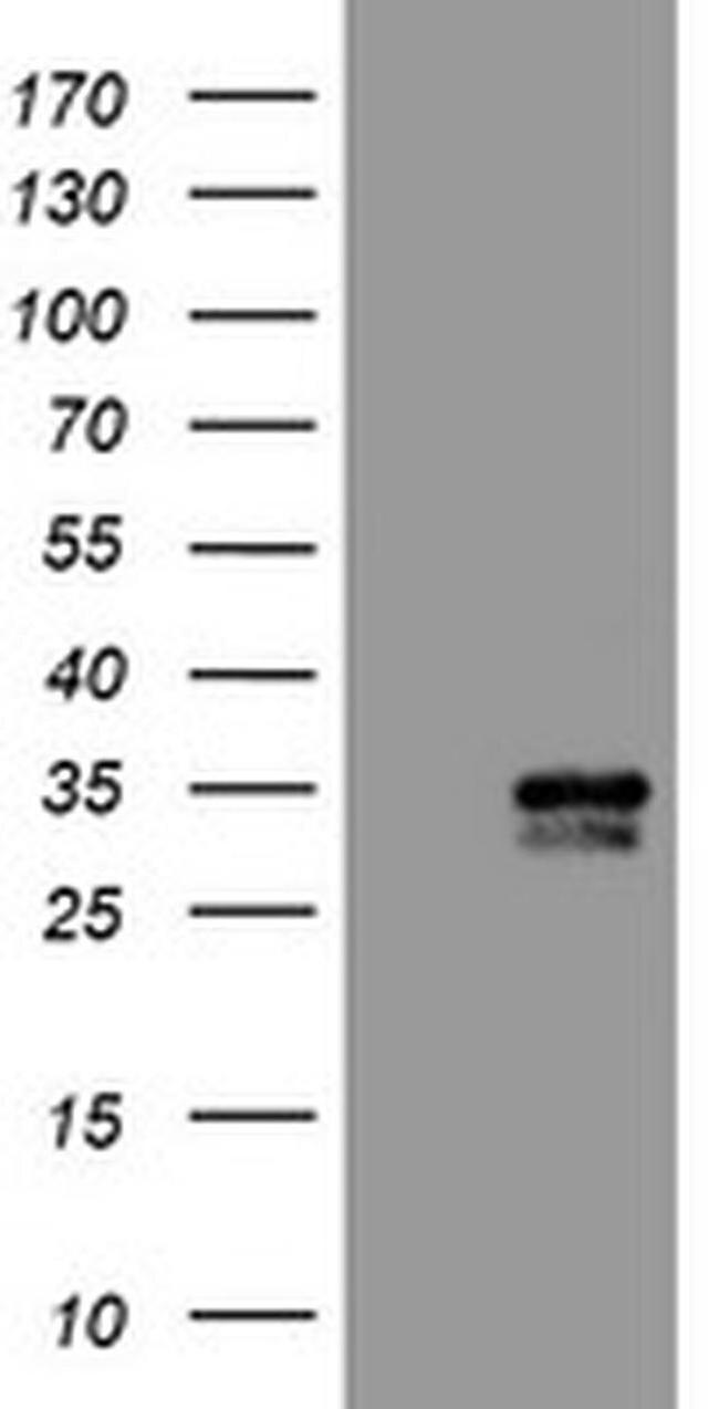 PBDC1 Antibody in Western Blot (WB)