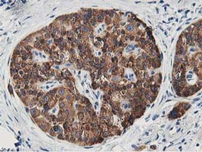 LCMT1 Antibody in Immunohistochemistry (Paraffin) (IHC (P))