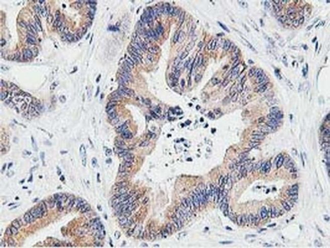 LCMT1 Antibody in Immunohistochemistry (Paraffin) (IHC (P))