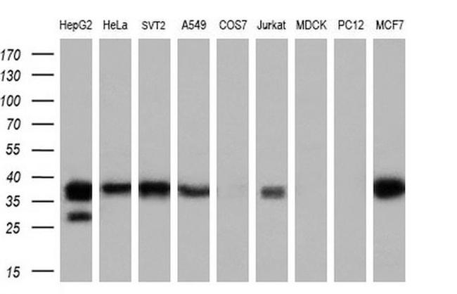 LCMT1 Antibody in Western Blot (WB)