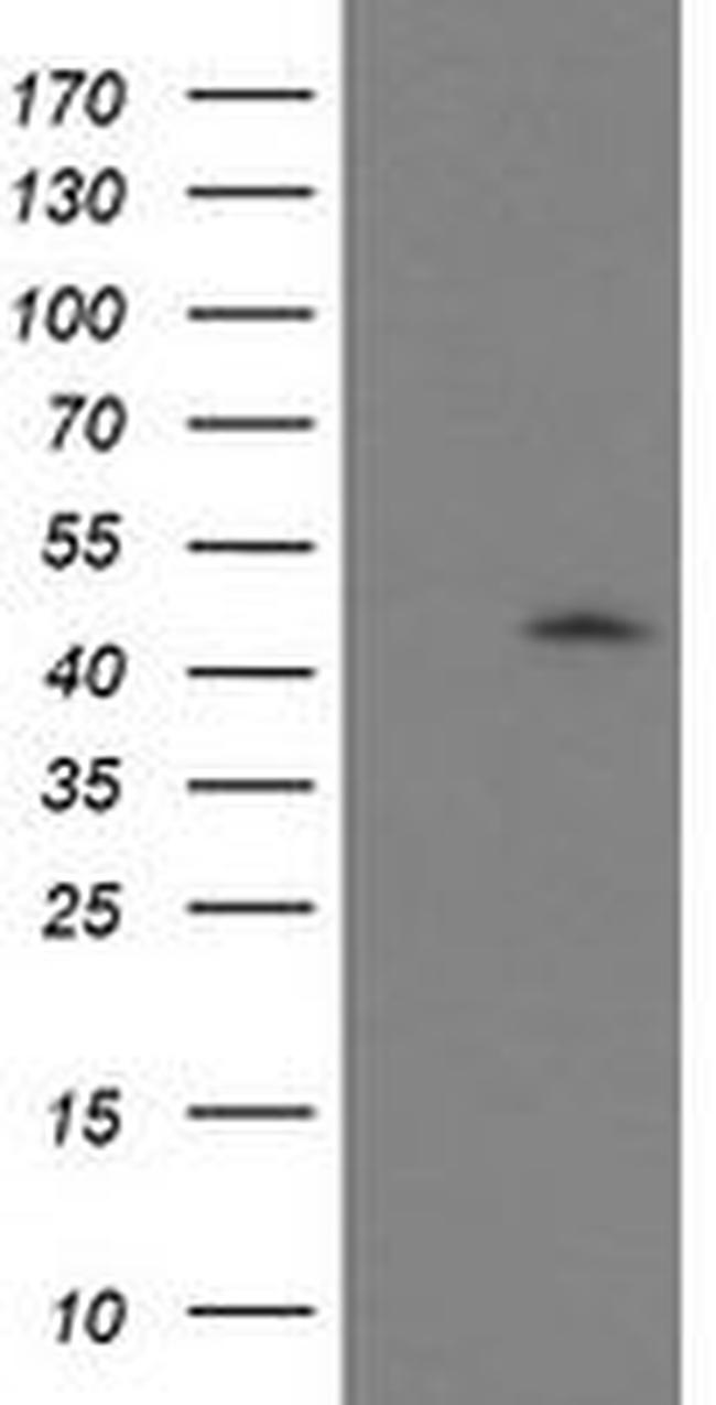 GDAP1L1 Antibody in Western Blot (WB)