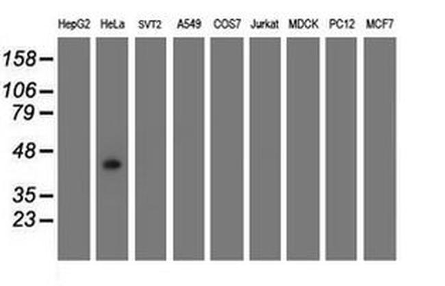 GDAP1L1 Antibody in Western Blot (WB)