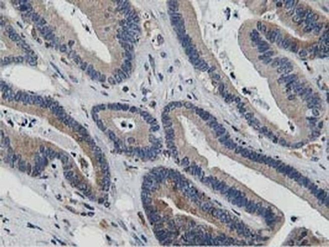 ATG3 Antibody in Immunohistochemistry (Paraffin) (IHC (P))