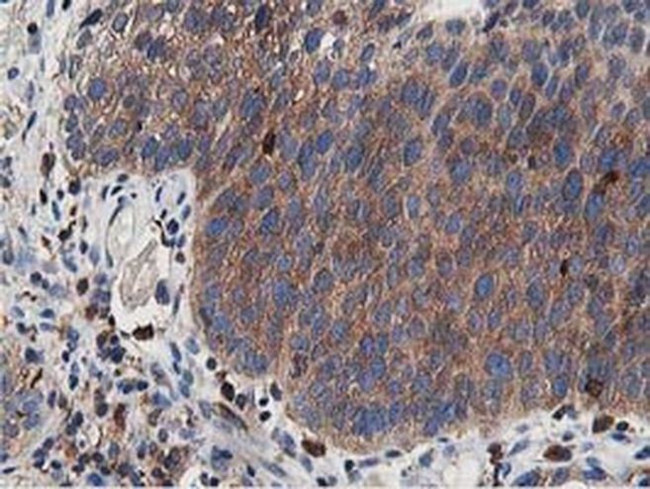 ATG3 Antibody in Immunohistochemistry (Paraffin) (IHC (P))