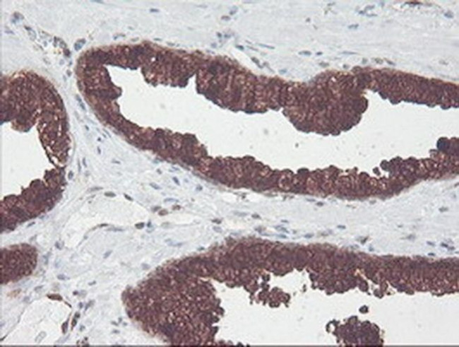 CNDP2 Antibody in Immunohistochemistry (Paraffin) (IHC (P))