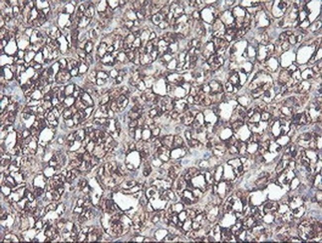 CNDP2 Antibody in Immunohistochemistry (Paraffin) (IHC (P))