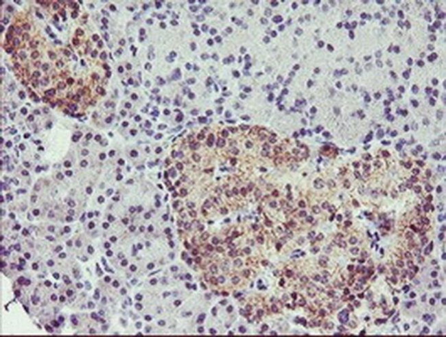 TMOD1 Antibody in Immunohistochemistry (Paraffin) (IHC (P))