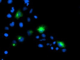 PTP1B Antibody in Immunocytochemistry (ICC/IF)