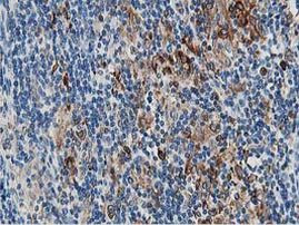 PTP1B Antibody in Immunohistochemistry (Paraffin) (IHC (P))