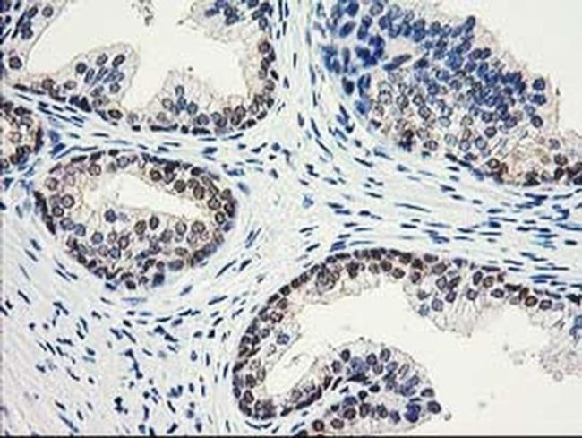 Aminoacylase Antibody in Immunohistochemistry (Paraffin) (IHC (P))