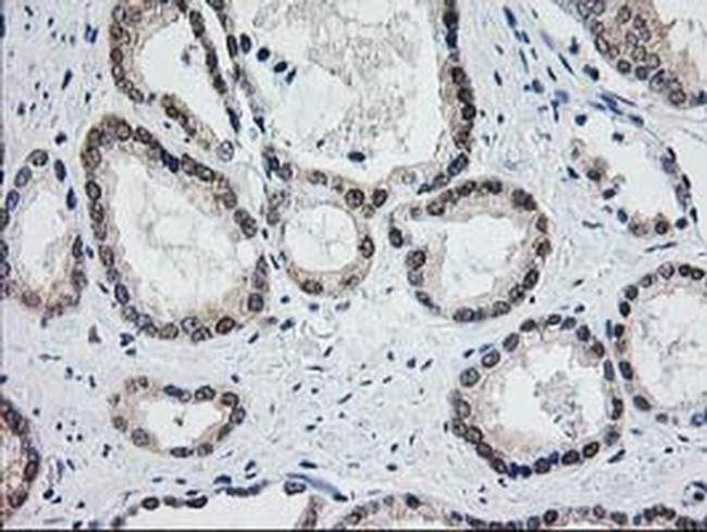 Aminoacylase Antibody in Immunohistochemistry (Paraffin) (IHC (P))