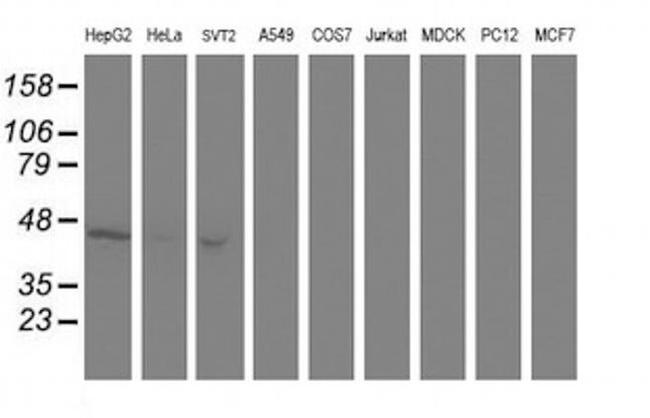 Aminoacylase Antibody in Western Blot (WB)