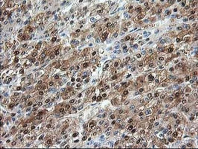 Aminoacylase Antibody in Immunohistochemistry (Paraffin) (IHC (P))