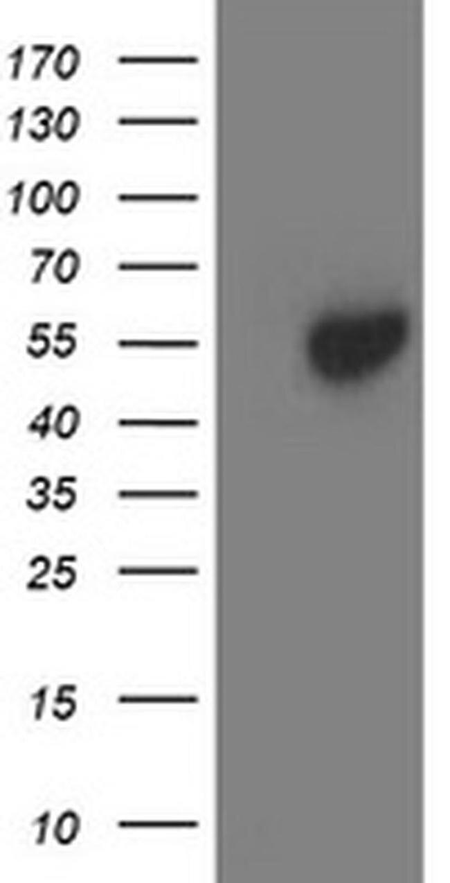 Aminoacylase Antibody in Western Blot (WB)