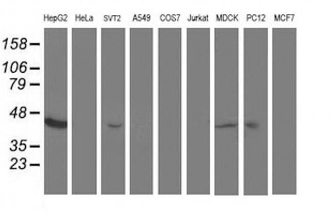 Aminoacylase Antibody in Western Blot (WB)