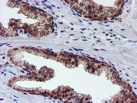 PSMD2 Antibody in Immunohistochemistry (Paraffin) (IHC (P))