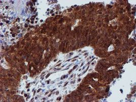 PSMD2 Antibody in Immunohistochemistry (Paraffin) (IHC (P))