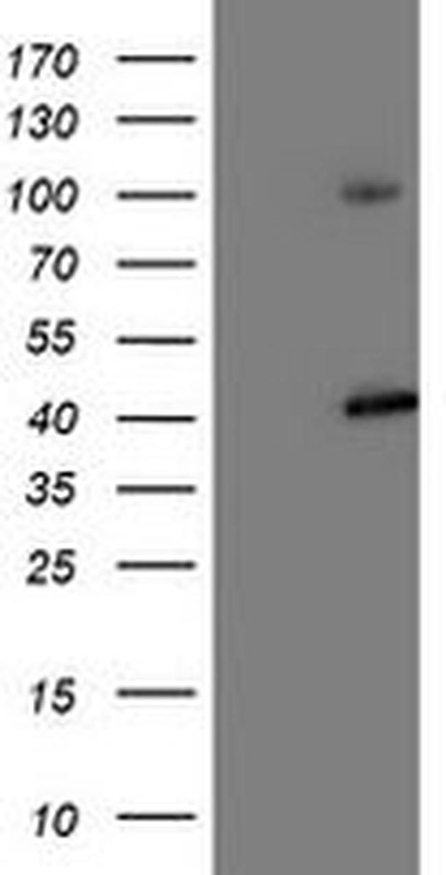 PSMD2 Antibody in Western Blot (WB)