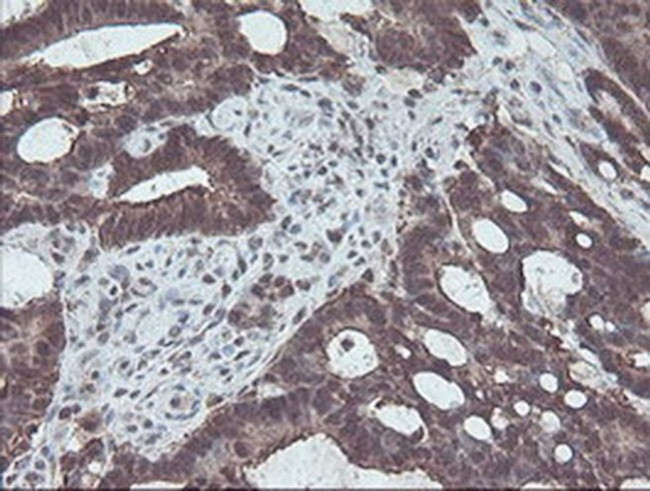 CBR3 Antibody in Immunohistochemistry (Paraffin) (IHC (P))