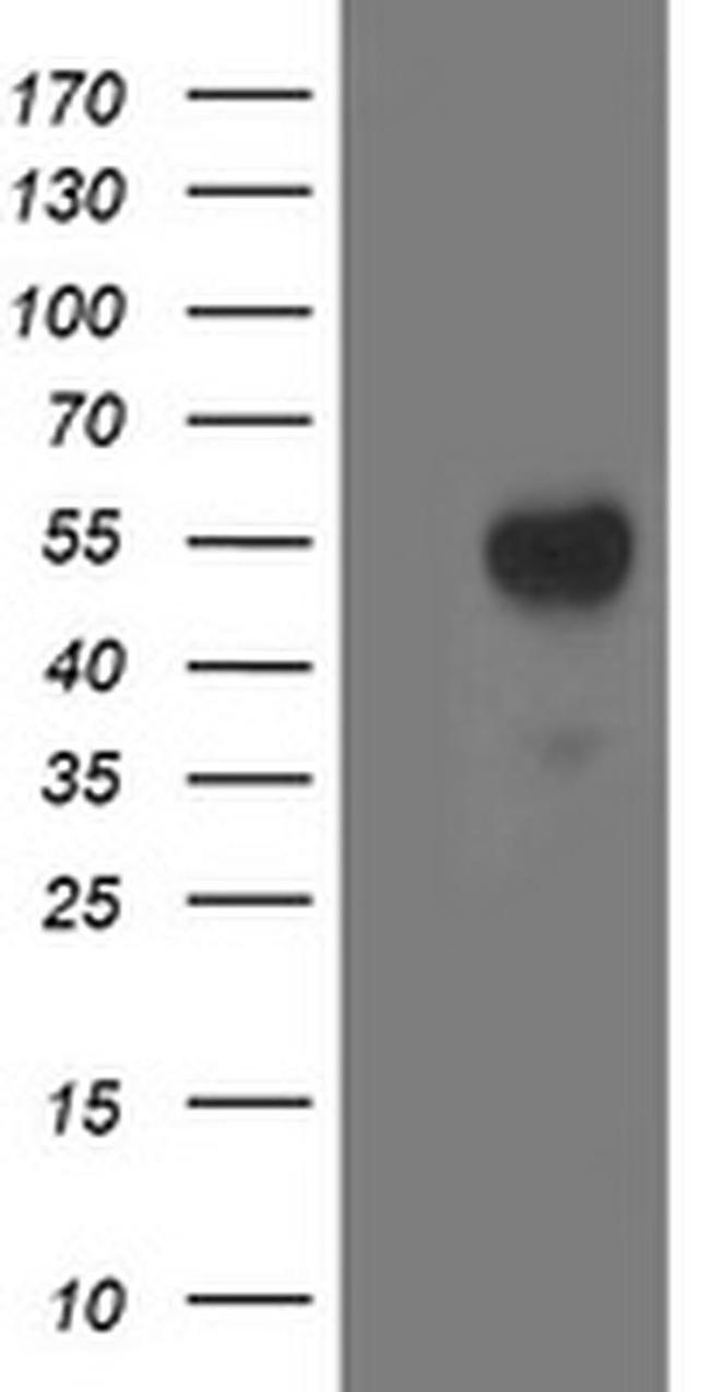 Aminoacylase Antibody in Western Blot (WB)