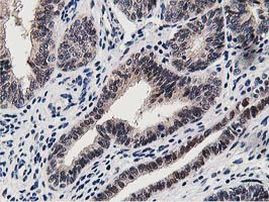 DPP3 Antibody in Immunohistochemistry (Paraffin) (IHC (P))