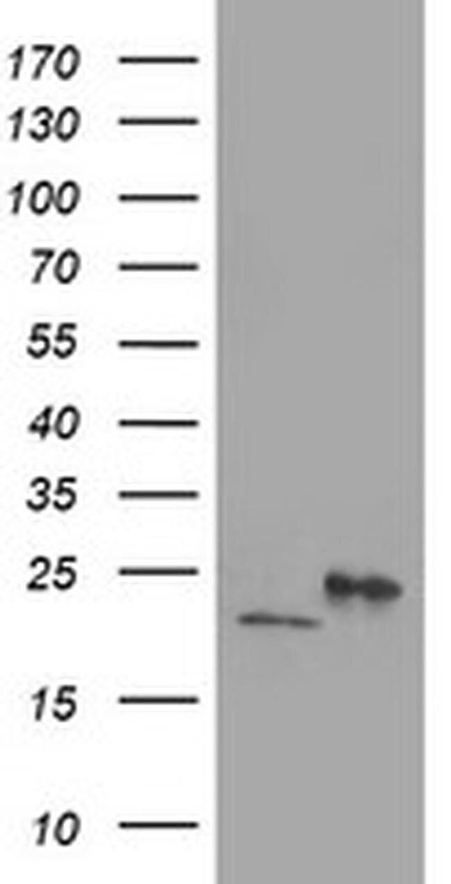 DHFRL1 Antibody in Western Blot (WB)