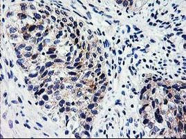 XPNPEP3 Antibody in Immunohistochemistry (Paraffin) (IHC (P))