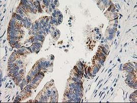 Adenylate Kinase 4 Antibody in Immunohistochemistry (Paraffin) (IHC (P))