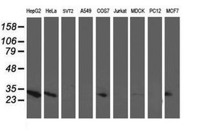 Adenylate Kinase 4 Antibody in Western Blot (WB)