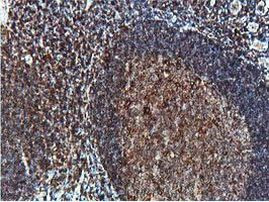 PTP1B Antibody in Immunohistochemistry (Paraffin) (IHC (P))