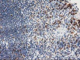 PTP1B Antibody in Immunohistochemistry (Paraffin) (IHC (P))