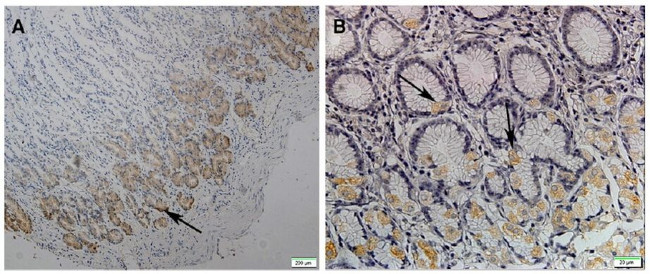 LGR5 Antibody in Immunohistochemistry (Paraffin) (IHC (P))