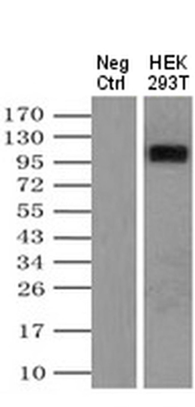 LGR5 Antibody in Immunoprecipitation (IP)