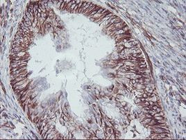 MCAK Antibody in Immunohistochemistry (Paraffin) (IHC (P))