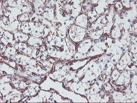 MCAK Antibody in Immunohistochemistry (Paraffin) (IHC (P))