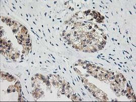 BAIAP2 Antibody in Immunohistochemistry (Paraffin) (IHC (P))