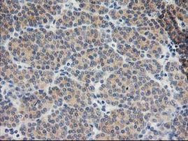 BAIAP2 Antibody in Immunohistochemistry (Paraffin) (IHC (P))