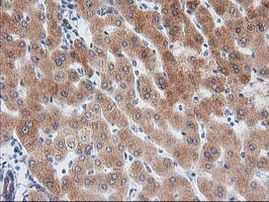 BAIAP2 Antibody in Immunohistochemistry (Paraffin) (IHC (P))