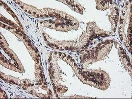 NUDT9 Antibody in Immunohistochemistry (Paraffin) (IHC (P))