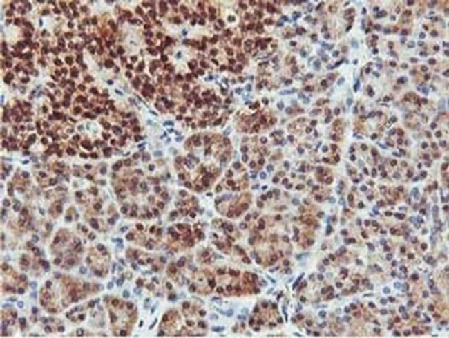 CoA Synthase Antibody in Immunohistochemistry (Paraffin) (IHC (P))