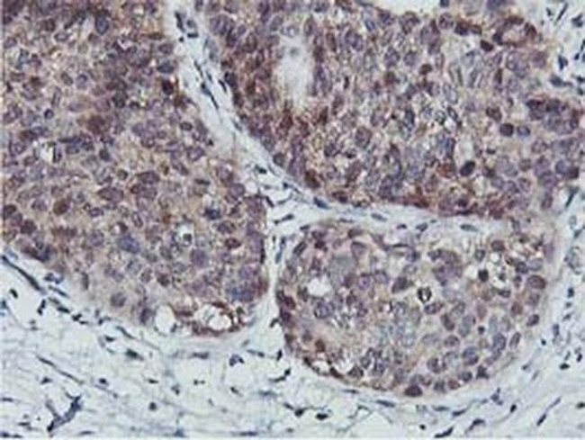 CoA Synthase Antibody in Immunohistochemistry (Paraffin) (IHC (P))