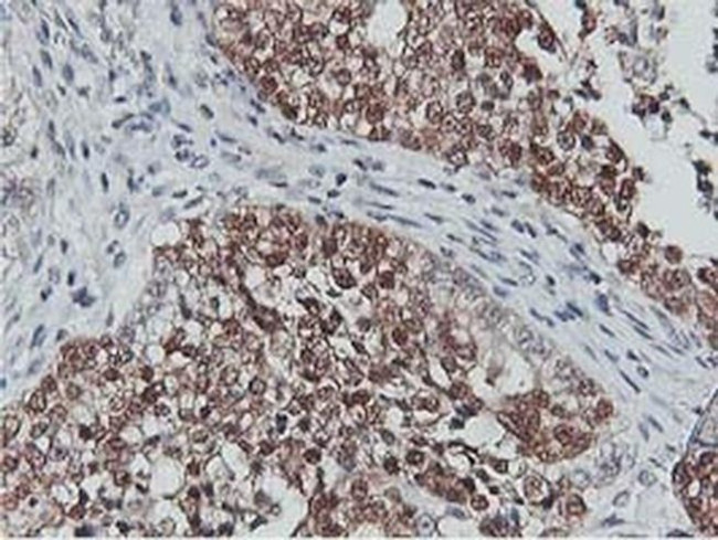 CoA Synthase Antibody in Immunohistochemistry (Paraffin) (IHC (P))