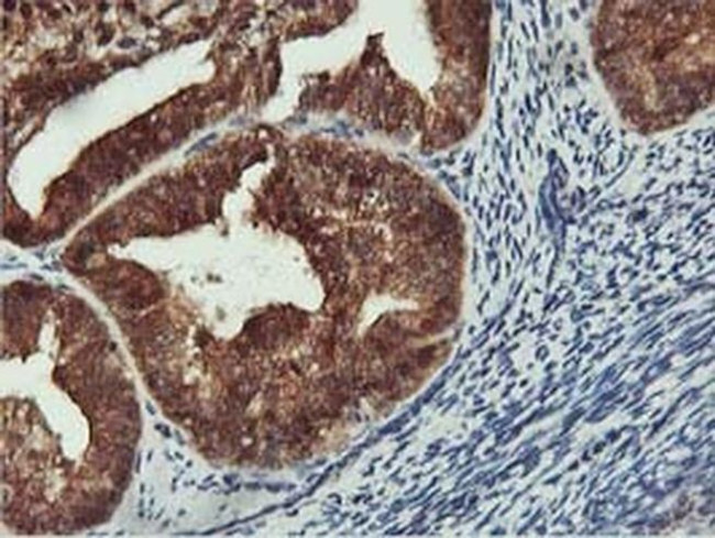 CoA Synthase Antibody in Immunohistochemistry (Paraffin) (IHC (P))